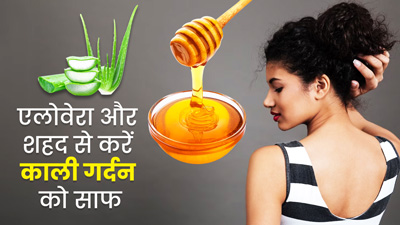 गर्मियों में काली पड़ी गर्दन को साफ करने के लिए लगाएं एलोवेरा और शहद, जानें इस्तेमाल का तरीका