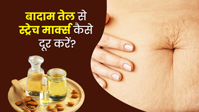 स्ट्रेच मार्क्स दूर करने के लिए इस तरह लगाएं बादाम का तेल, जल्द मिलेगा फायदा