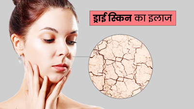 गर्मी और धूप के कारण ड्राई हो गई है स्‍क‍िन, तो ऐसे करें दही का इस्‍तेमाल, लौट आएगा न‍िखार  