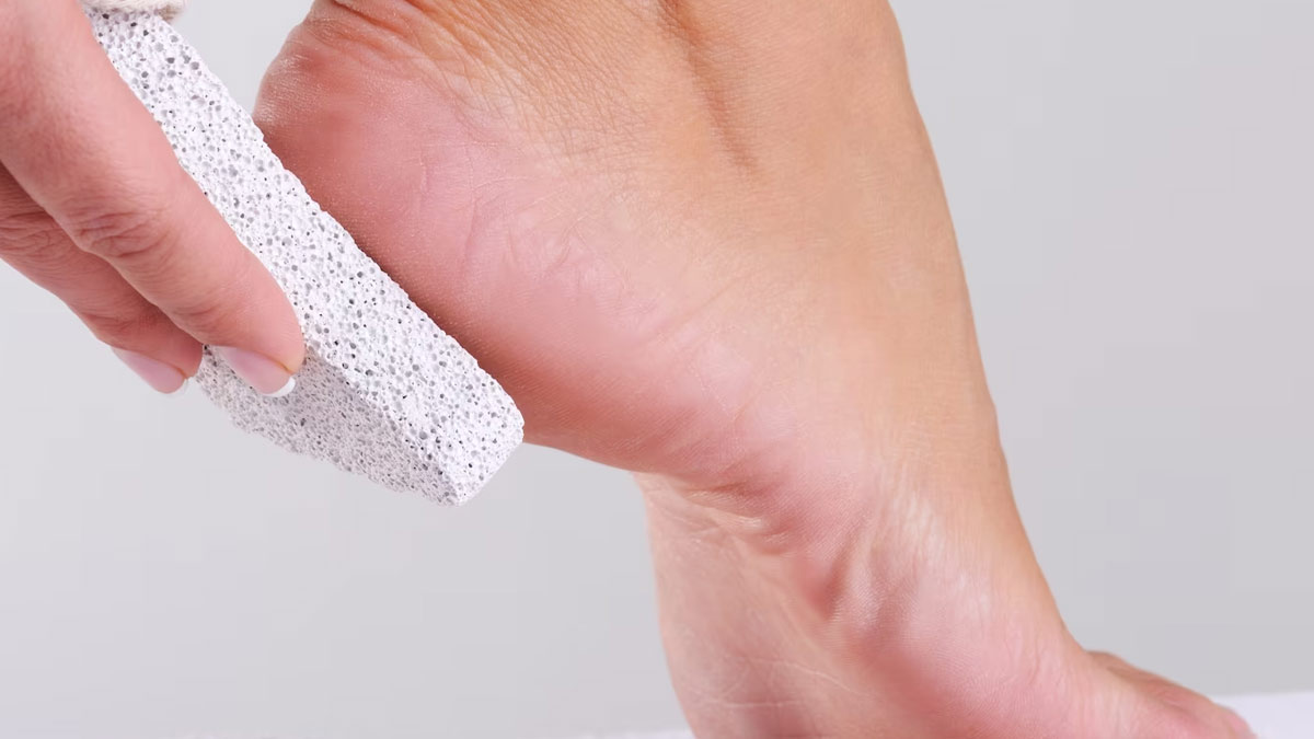 Home Remedies For Peeling Skin On Feet