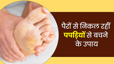 पैरों की स्किन से निकल रही हैं पपड़ियां? इन 5 घरेलू उपाय से पाएं छुटकारा