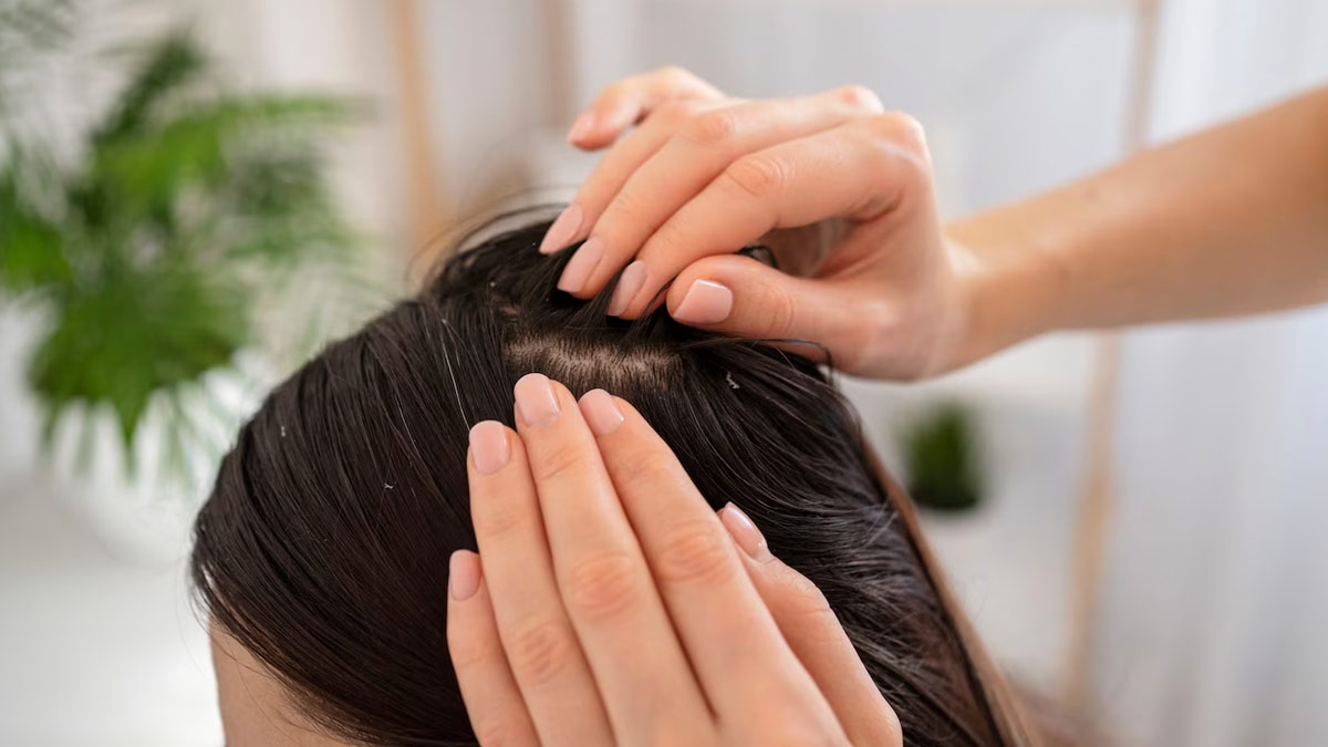 scalp fungal infection prevention tips 