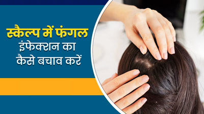 सिर की स्कैल्प में फंगल इंफेक्शन से बचाव कैसे करें? जानें इस समस्या के लक्षण