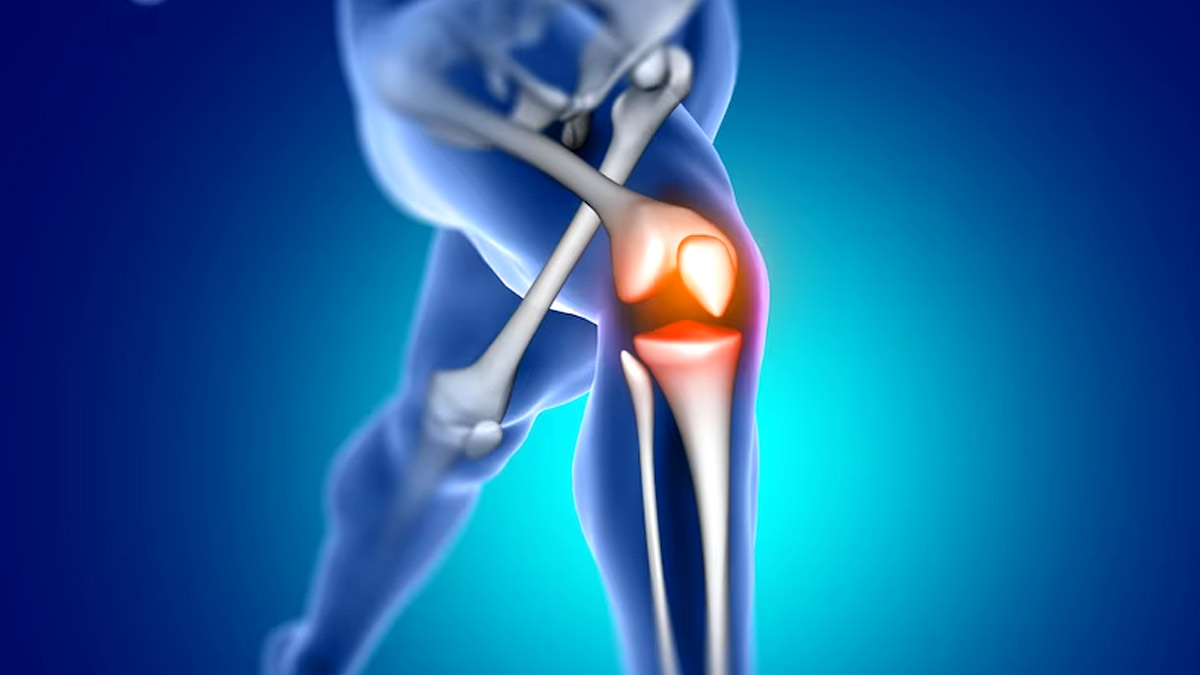 Anterior Cruciate Ligament Injury: What If It Is Neglected?