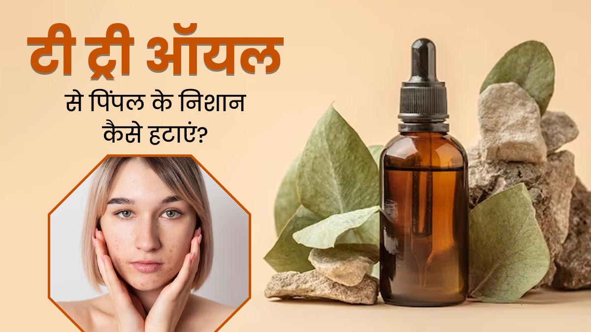 मुंहासों के दाग हटाने के लिए टी ट्री ऑयल का इन 4 तरीकों से करें इस्तेमाल, मिलेगी साफ और बेदाग त्वचा