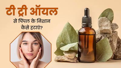 मुंहासों के दाग हटाने के लिए टी ट्री ऑयल का इन 4 तरीकों से करें इस्तेमाल, मिलेगी साफ और बेदाग त्वचा