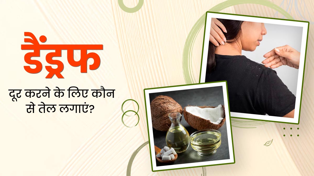 डैंड्रफ की समस्या से हैं परेशान? सिर पर लगाएं ये 5 तेल, खुजली और रूसी से मिलेगा छुटकारा