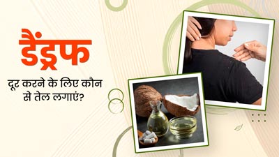 डैंड्रफ की समस्या से हैं परेशान? सिर पर लगाएं ये 5 तेल, खुजली और रूसी से मिलेगा छुटकारा
