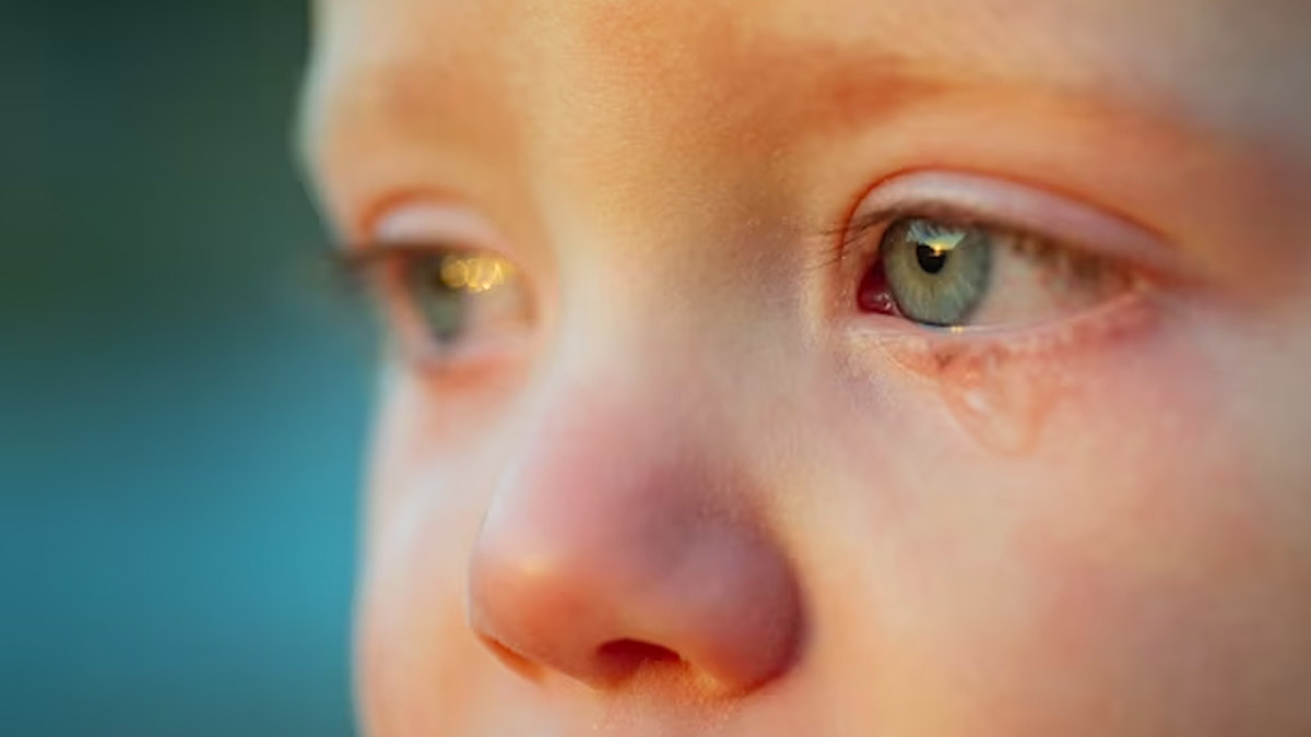Prevention of conjunctivitis in toddlers