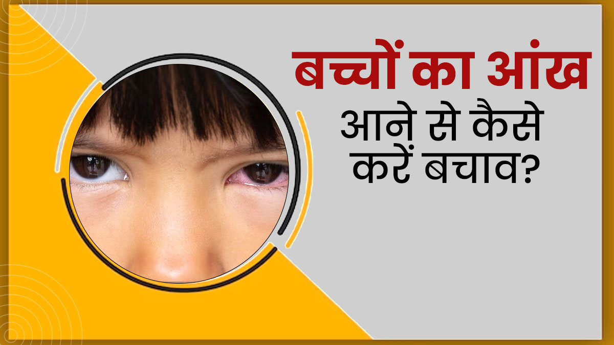 बच्चों को कंजंक्टिवाइटिस (Eye Flu) से बचाने के लिए अपनाएं ये 5 उपाय