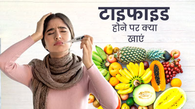 टाइफाइड होने पर डाइट में शामिल करें ये 5 फूड्स, मिलेगा आराम 
