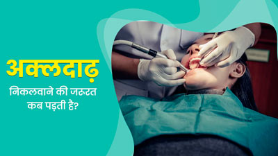 इन 5 परिस्थितियों में पड़ती है अक्लदाढ़ निकलवाने की जरूरत, न करें अनदेखी