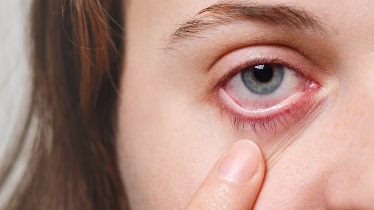 eye flu affect eye sight
