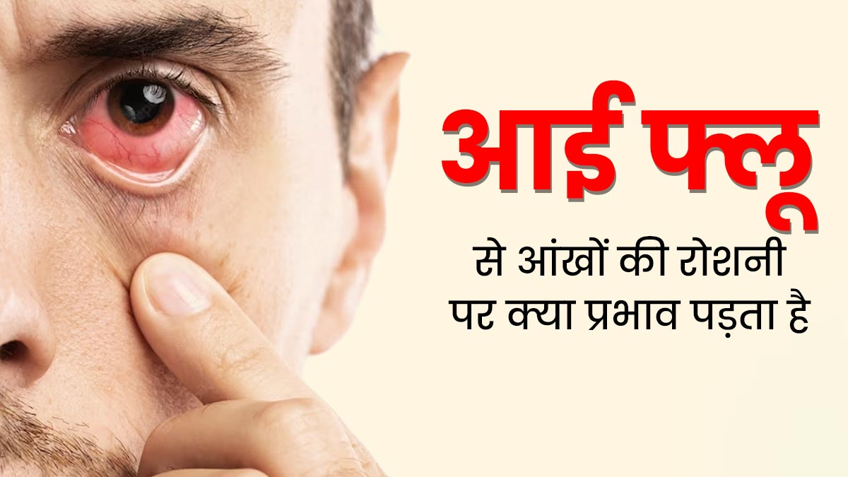 क्या आई फ्लू होने पर आंखों की रोशनी प्रभावित होती है? जानें डॉक्टर की राय  