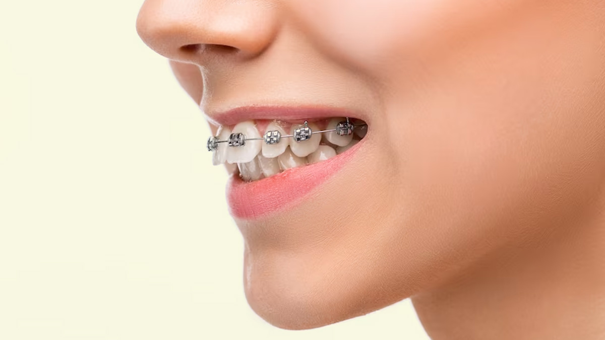 is orthodontic treatment safe