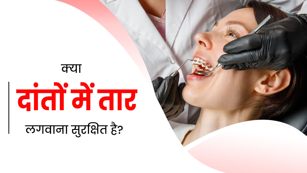 क्या ऑर्थोडोंटिक उपचार (दांतों में तार) कराना सुरक्षित होता है? जानें एक्सपर्ट की राय