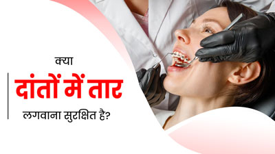 क्या ऑर्थोडोंटिक उपचार (दांतों में तार) कराना सुरक्षित होता है? जानें एक्सपर्ट की राय