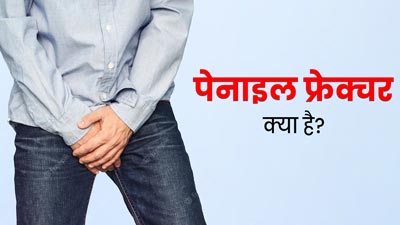 पेनाइल फ्रेक्चर क्या है? पुरुषों को जरूर जानना चाहिए इसके बारे में
