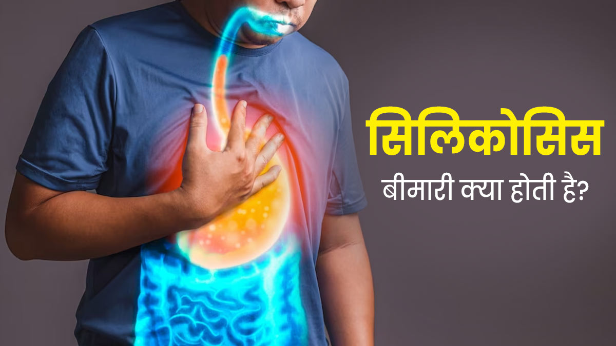 सिलिकोसिस की बीमारी से हर साल होती है लाखों मजदूरों की मौत, जानें इसके बारे में