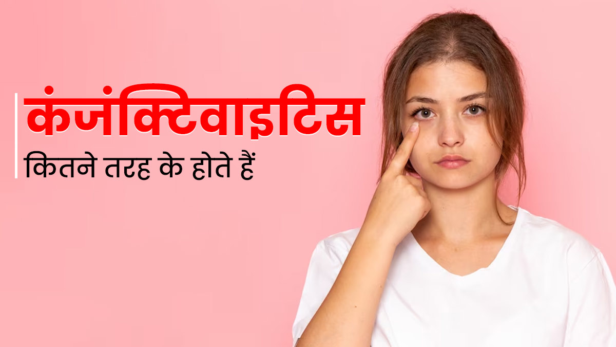 Conjunctivitis: 5 तरह के होते हैं कंजंक्टिवाइटिस (आई फ्लू), इन तरीकों से करें पहचान