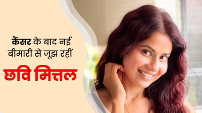 कैंसर के बाद एक्ट्रेस छवि मित्तल को हुआ कॉस्टोकॉन्ड्राइटिस, जानें क्या है यह बीमारी