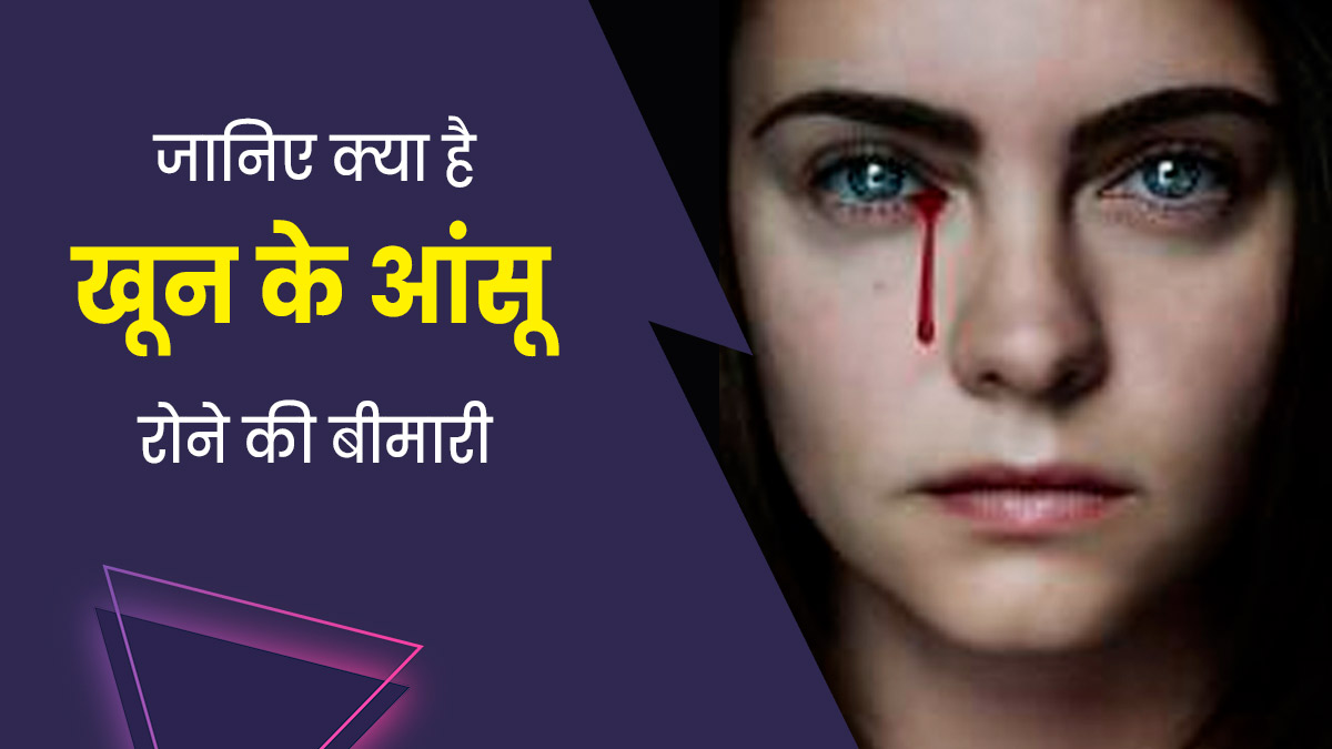 Haemolacria: खून के आंसू रुला देती है आंखों की यह बीमारी, जानें इसके लक्षण और कारण 