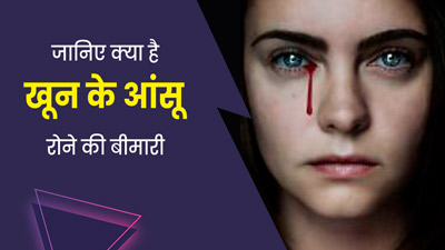 Haemolacria: खून के आंसू रुला देती है आंखों की यह बीमारी, जानें इसके लक्षण और कारण 