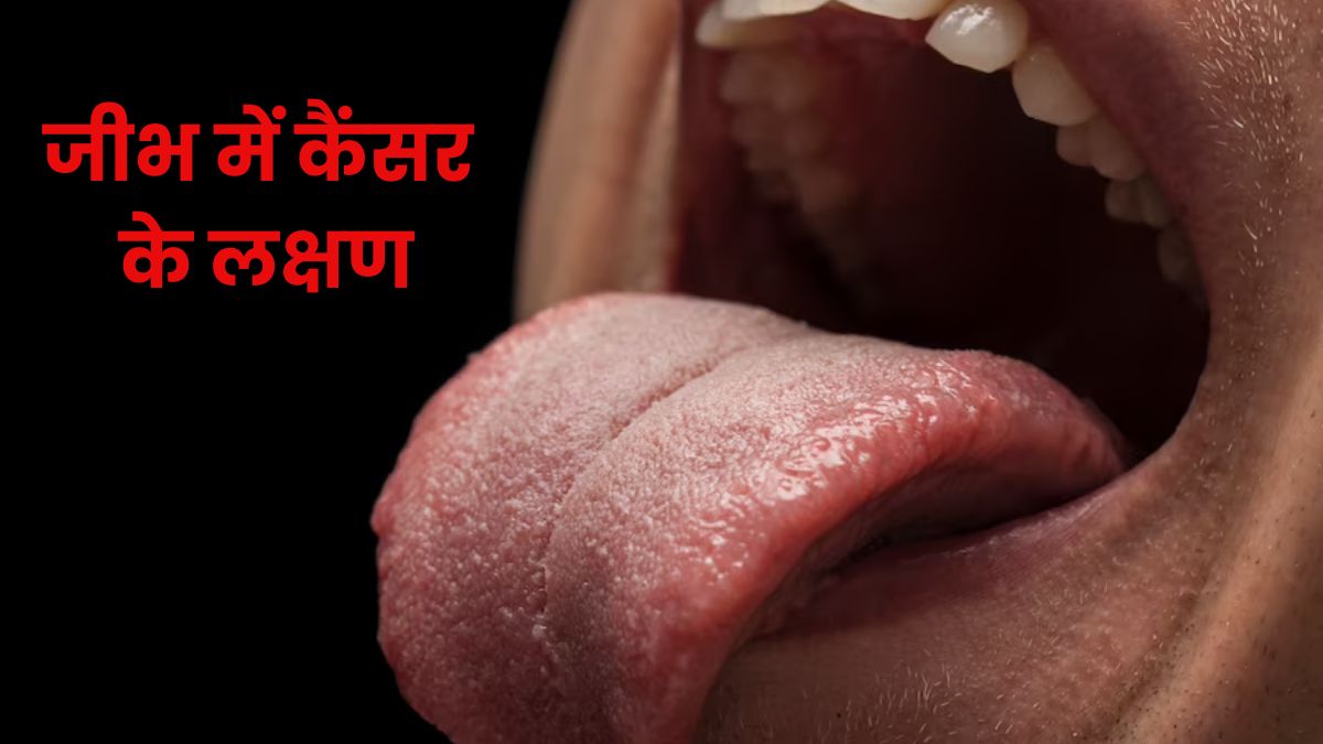 शरीर में कैंसर की शुरुआत होने पर जीभ में दिखते हैं ये लक्षण, जानें कैसे करें पहचान