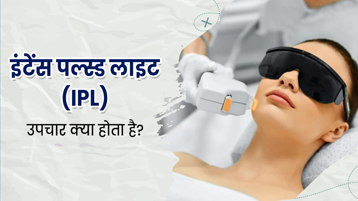 इंटेंस पल्स्ड लाइट (IPL) ट्रीटमेंट क्‍या होता है? एक्‍सपर्ट से जानें त्‍वचा के ल‍िए इसके फायदे-नुकसान  