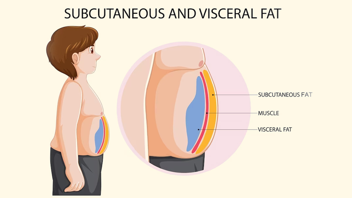 Visceral fat: Here Are Some Remedies To Reduce It 