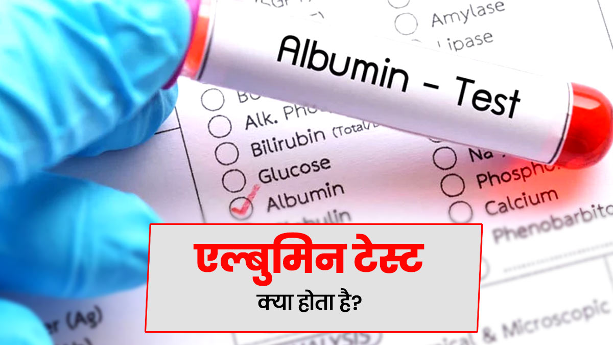 एल्बुमिन टेस्ट क्या है? जानें कब और क‍िन मरीजों को पड़ती है इस जांच की जरूरत