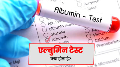 एल्बुमिन टेस्ट क्या है? जानें कब और क‍िन मरीजों को पड़ती है इस जांच की जरूरत