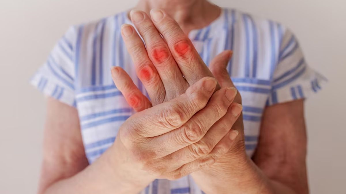 Arthritis In Fingers Causes