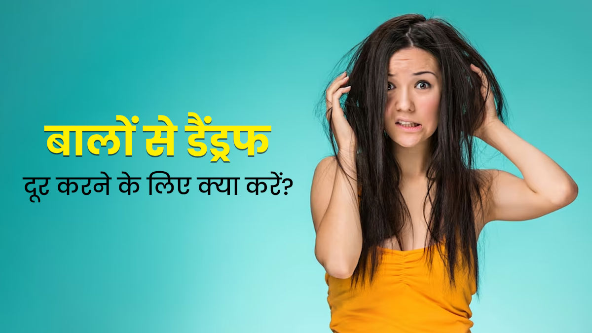 बालों में डैंड्रफ से हैं परेशान? इन 4 तरह के पानी से धोएं बाल, डैंड्रफ सहित कई समस्याएं होंगी दूर