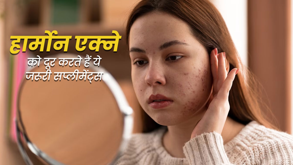 हार्मोन की गड़बड़ी भी बनती है मुंहासों का कारण, जानें इसे दूर करने के लिए जरूरी सप्लीमेंट्स 