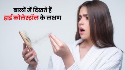 शरीर में बैड कोलेस्ट्रॉल बढ़ने पर बालों में दिखते हैं ये लक्षण, जानें कैसे करें कंट्रोल