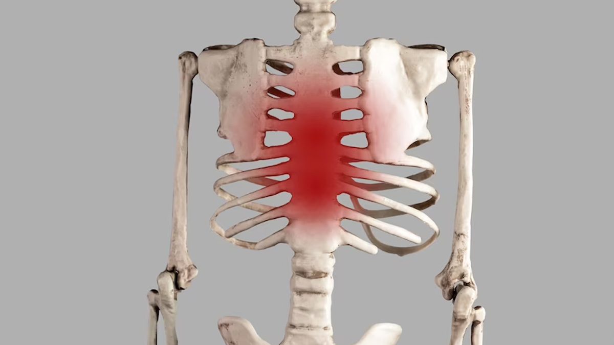 Costochondritis Symptoms, Diagnosis, and Treatment OnlyMyHealth