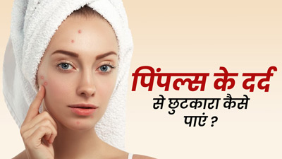 पिंपल्स में दर्द हो, तो अपनाएं ये 5 घरेलू उपाय, मिलेगा आराम