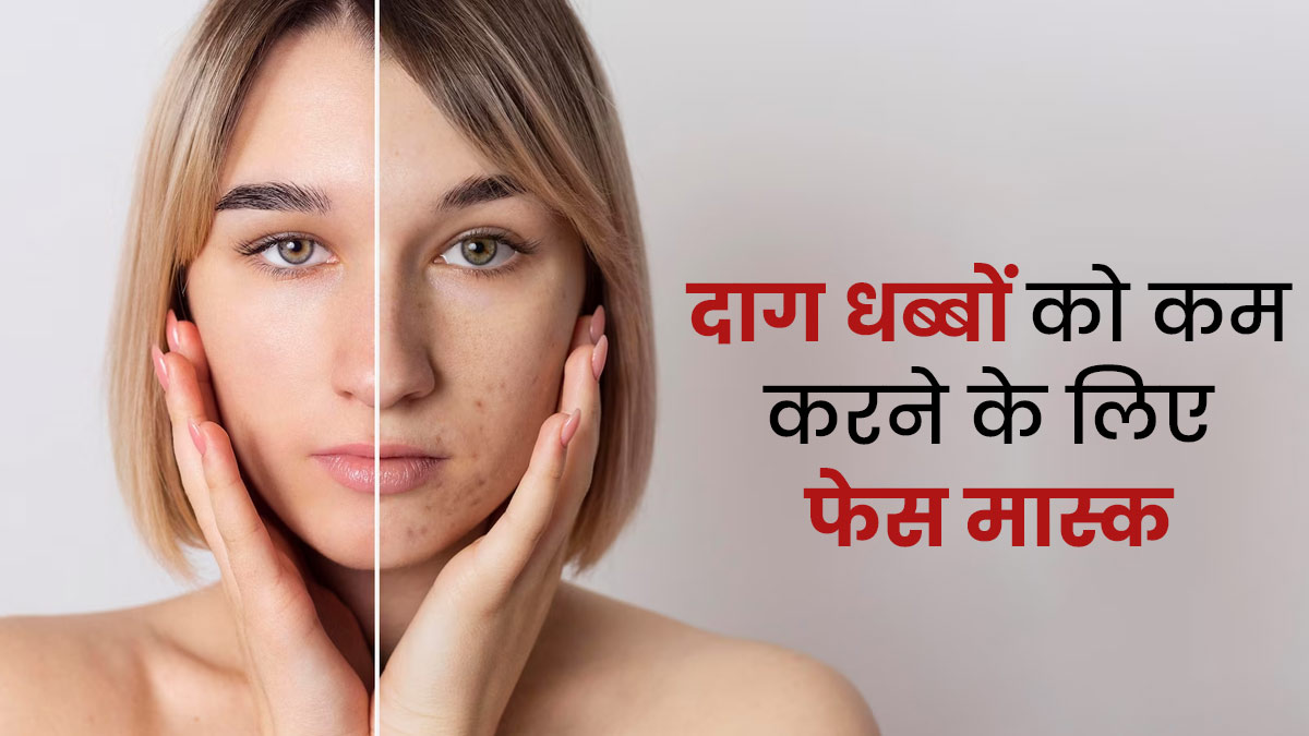 जिद्दी दाग धब्बों को कम करने के लिए चेहरे पर लगाएं ये 3 फेस मास्क, बेदाग दिखेगी त्वचा