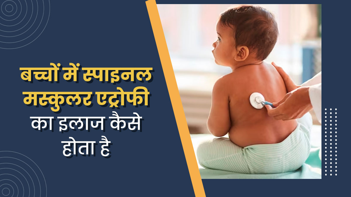 बच्चों में स्पाइनल मस्कुलर एट्रोफी का इलाज कैसे किया जाता है? डॉक्टर से जानें  