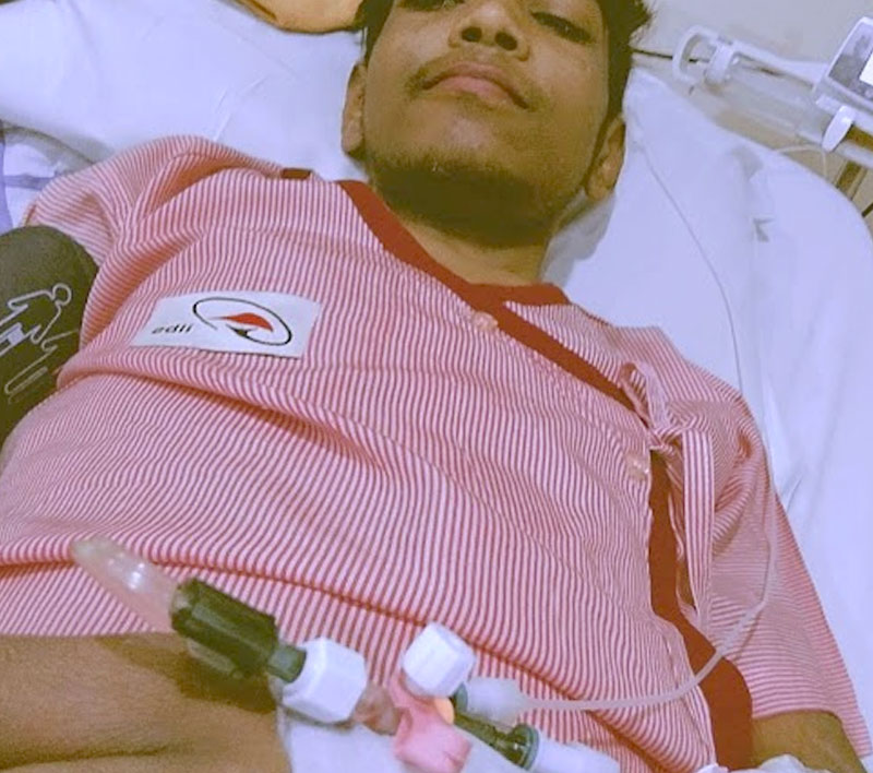Liver Transplant