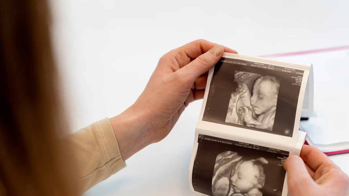 Fresh Vs Frozen Embryo Transfer