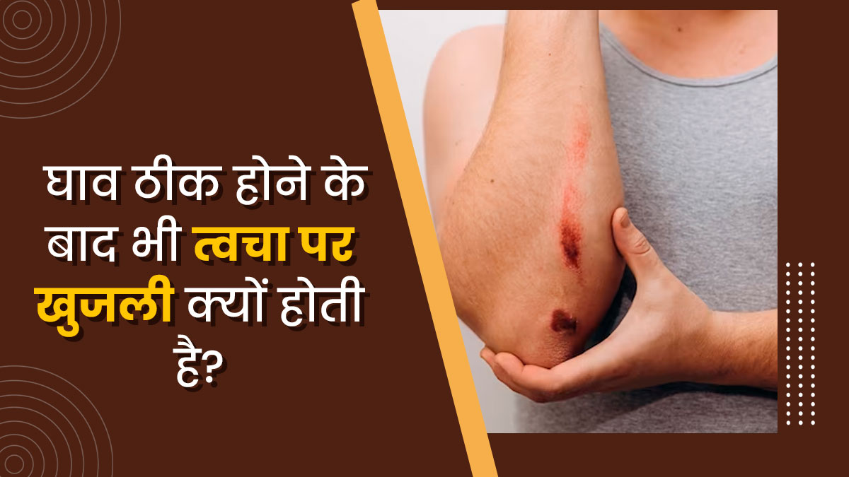 घाव ठीक होने के बाद त्वचा पर खुजली क्यों होने लगती है? एक्सपर्ट से जानें 