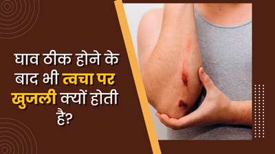 घाव ठीक होने के बाद त्वचा पर खुजली क्यों होने लगती है? एक्सपर्ट से जानें 