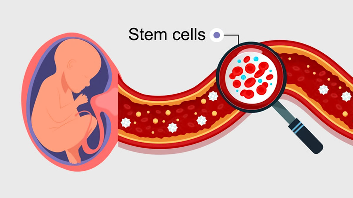 From Curing Cancer To Reversing Paralysis Doctor Explains The Role Of   Umbilical Cord Blood Stem Cells 