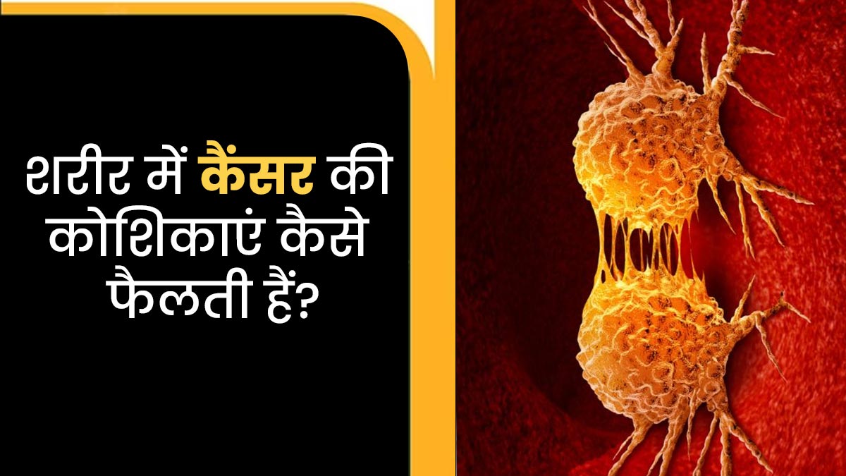 शरीर में कैसे फैलती हैं कैंसर कोश‍िकाएं? डॉक्टर से समझें पूरी प्रक्रिया