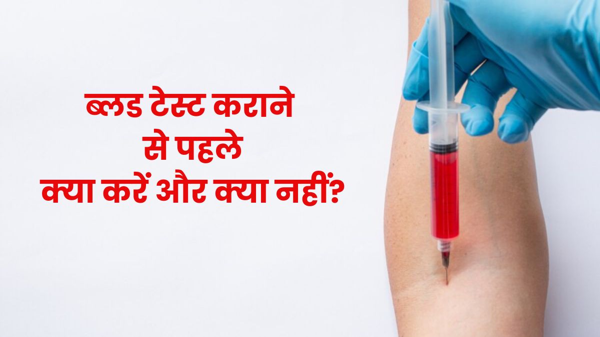 ब्लड टेस्ट कराने से पहले कुछ खाना चाहिए या नहीं? जानें इससे जुड़ी जरूरी सावधानियां