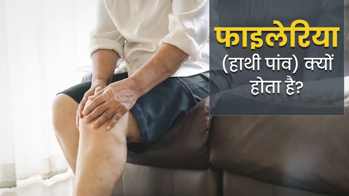 Filariasis: फाइलेरिया (हाथी पांव) की बीमारी क्यों होती है? डॉक्टर से आसान भाषा में समझें इसके कारण