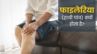 Filariasis: फाइलेरिया (हाथी पांव) की बीमारी क्यों होती है? डॉक्टर से आसान भाषा में समझें इसके कारण