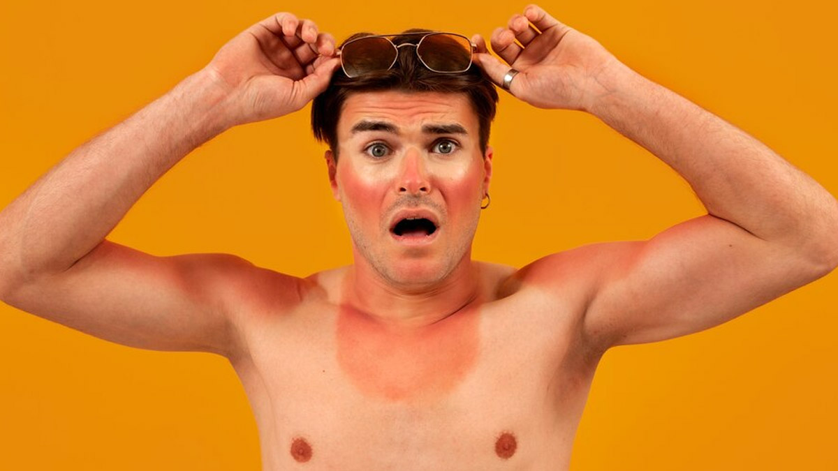 Skincare 101: What Is Tan and How It Is Different From Sunburn